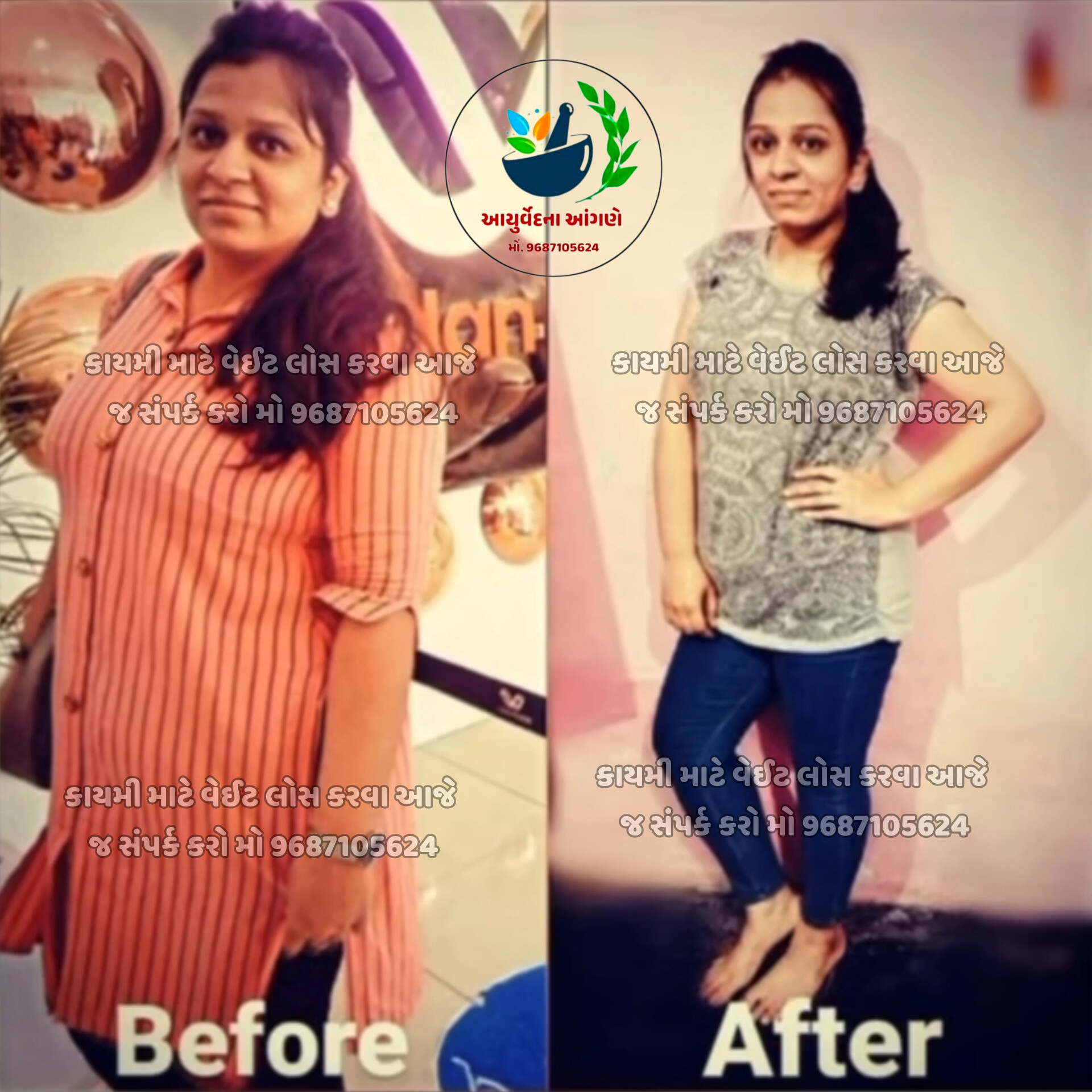 Natural fat reduction result image