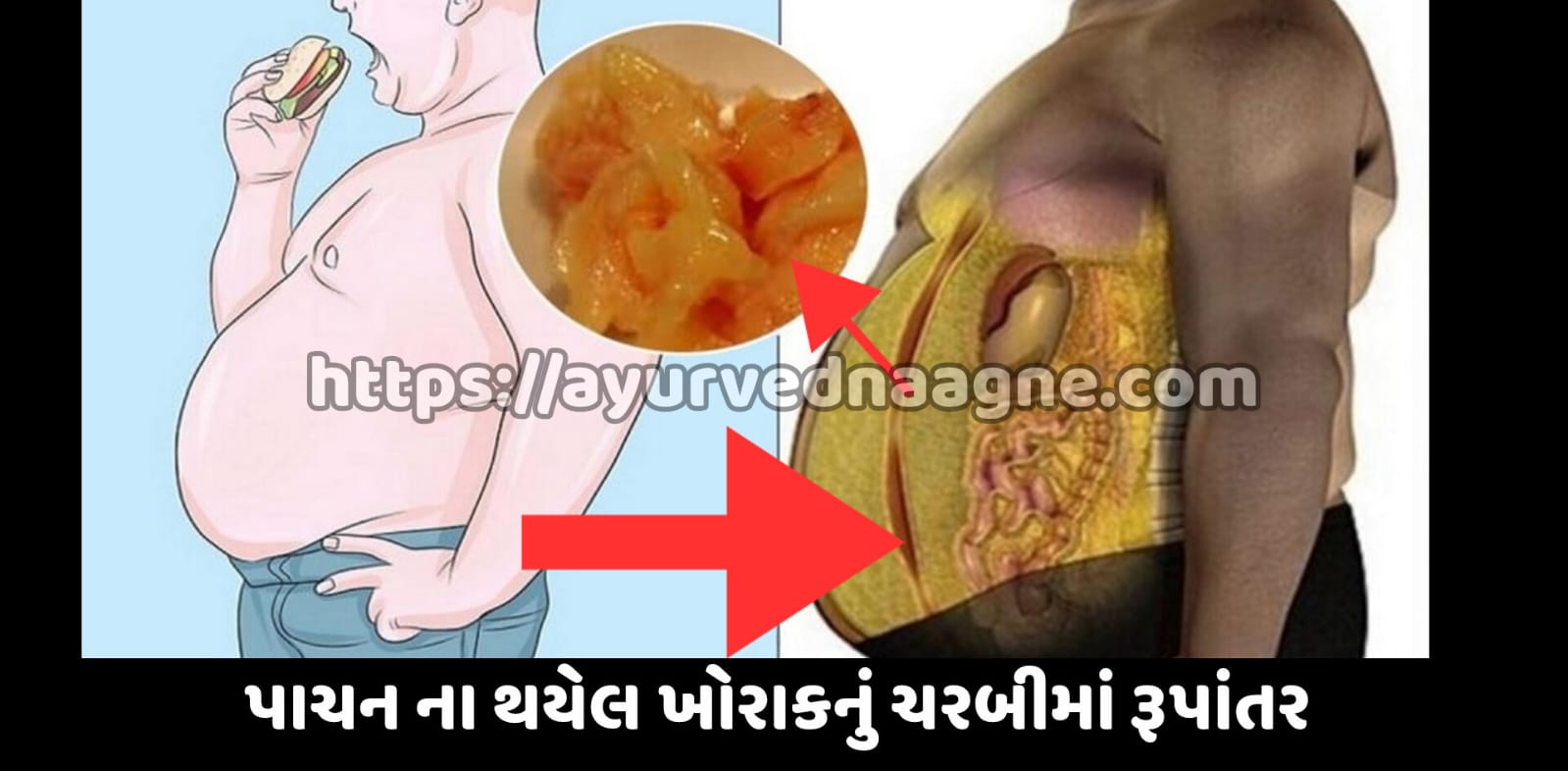 ડાયજેસ્ટીવ સિસ્ટમ