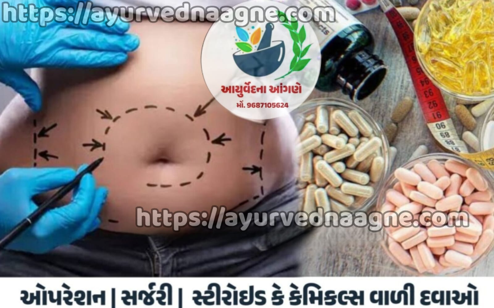 સાઇડ ઈફેક્ટ